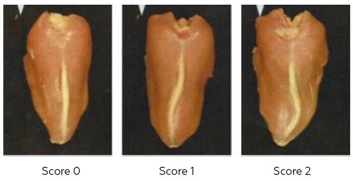 scores déviations bréchet